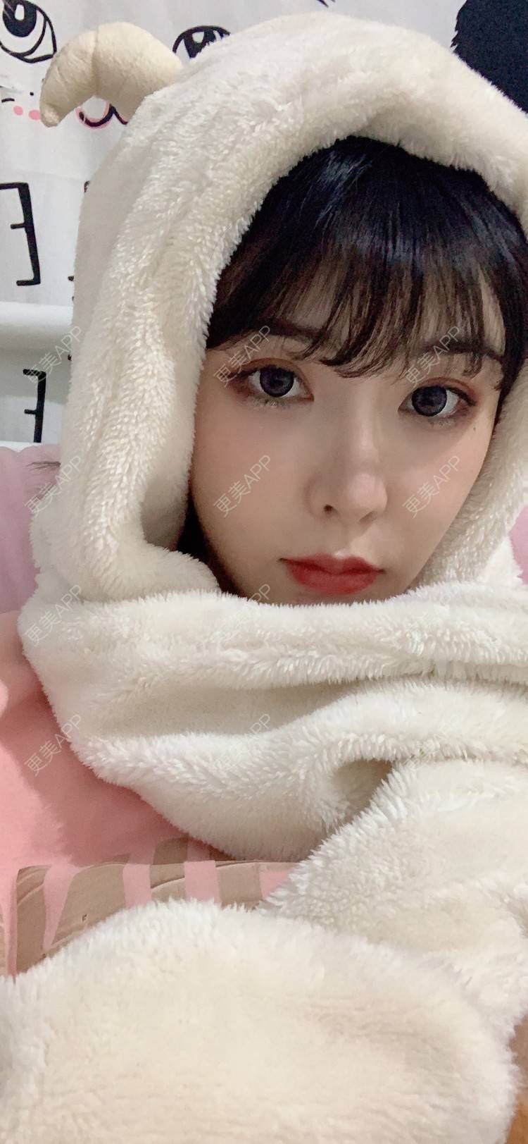 更美 - 更美用户tQrsyaKGg8的肋软骨隆鼻经验 | 北京 | 肋软骨隆鼻