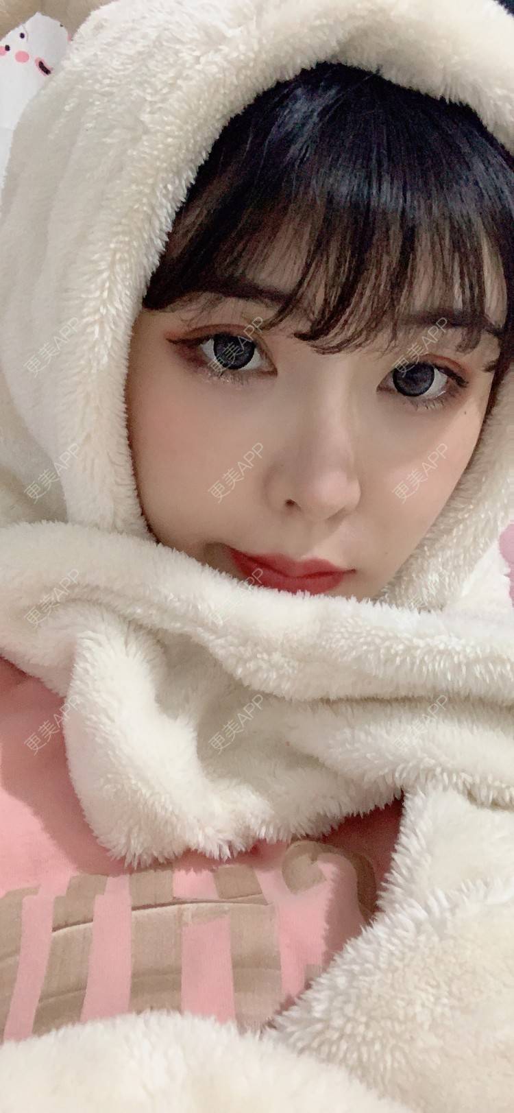 更美 - 更美用户tQrsyaKGg8的肋软骨隆鼻经验 | 北京 | 肋软骨隆鼻