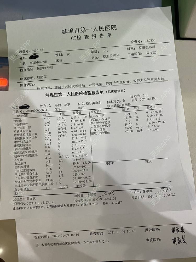 更美 - 全世界最开心的女孩子的唇综合经验 | 蚌埠 | 唇综合