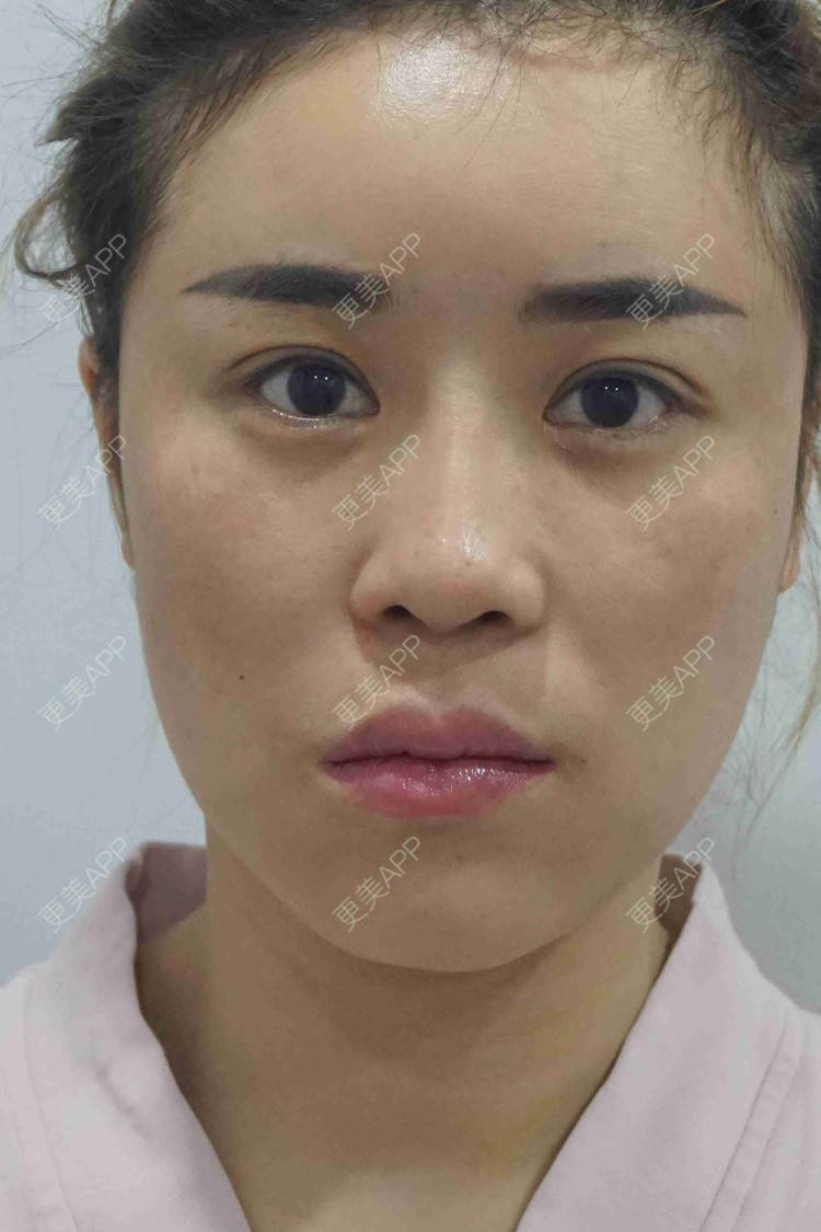 更美 - 穿花衣的燕子的鼻部多项经验 | 视频日记 | 鼻部多项 | 重庆