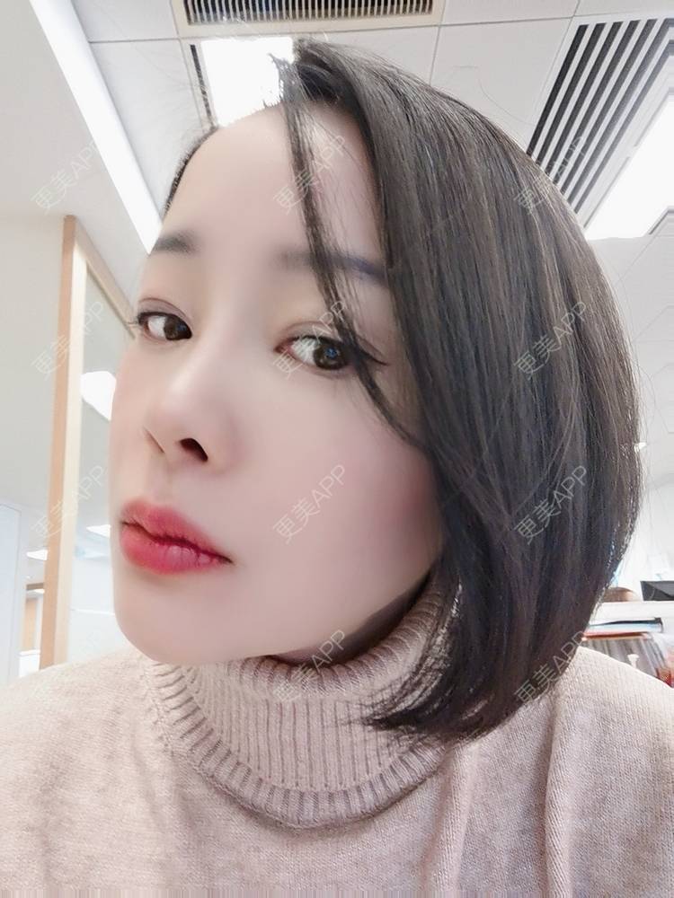 更美 - 🐷🐮仔仔仔的热玛吉经验 | 上海 | 热玛吉