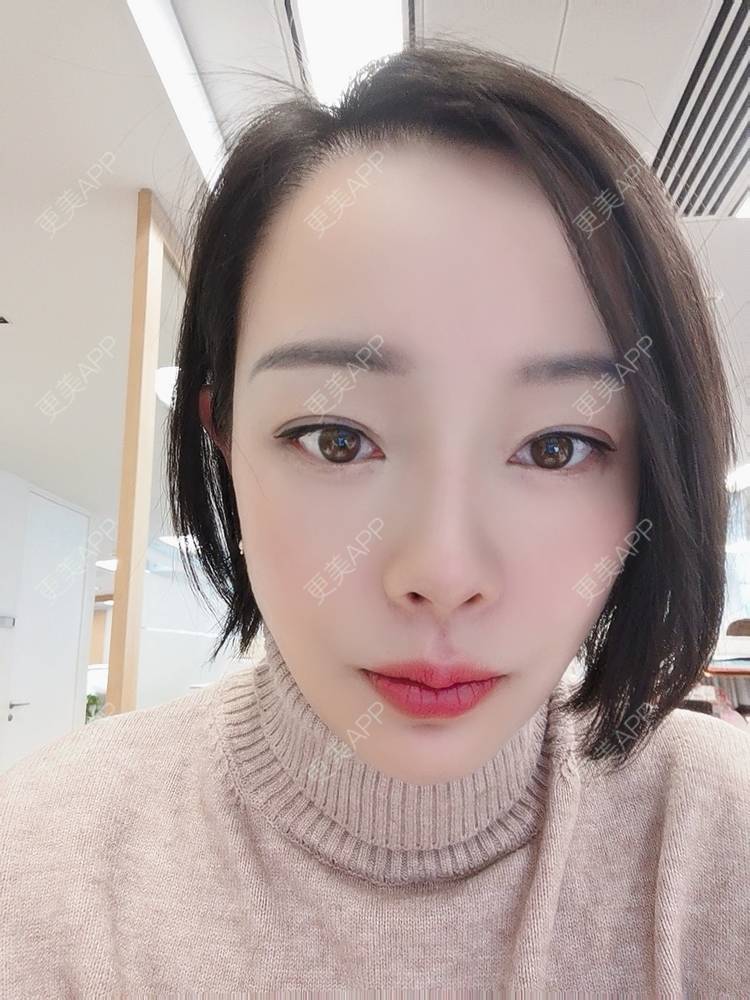 更美 - 🐷🐮仔仔仔的热玛吉经验 | 上海 | 热玛吉