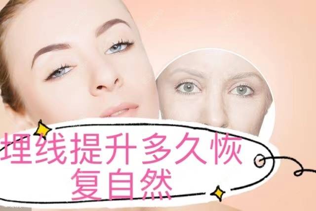 更美 - 更美用户2XAyod1VrR的经验 | 埋线提升