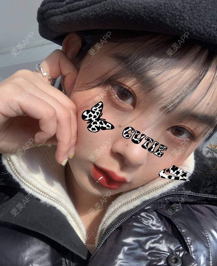 更美 - 更美用户YawSO7fXr0的颧弓降低经验 | 颧弓降低 | 深圳 | 颧骨颧弓整形