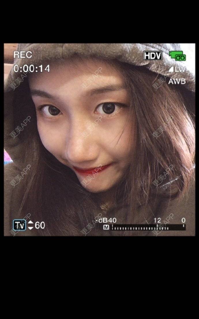 更美 - 更美用户0lmj7X3i2a的私处漂红经验 | 广州 | 私处漂红
