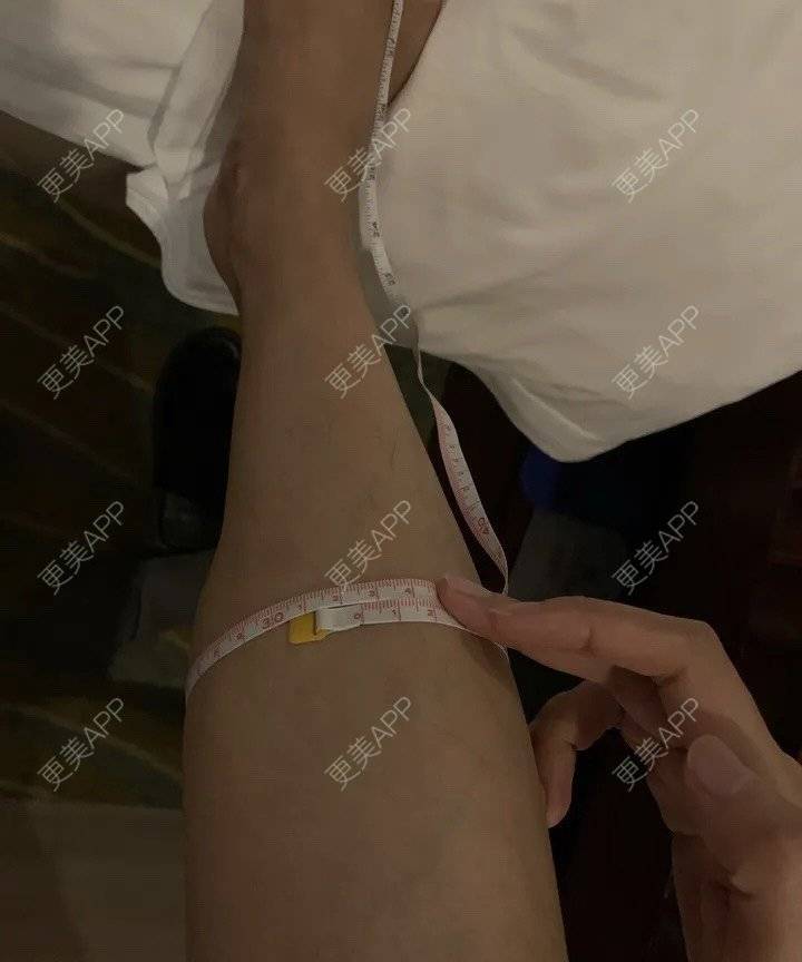 更美 - 更美用户BYgsCmMczy的注射塑形腿部经验 | 注射塑形腿部 | 广州
