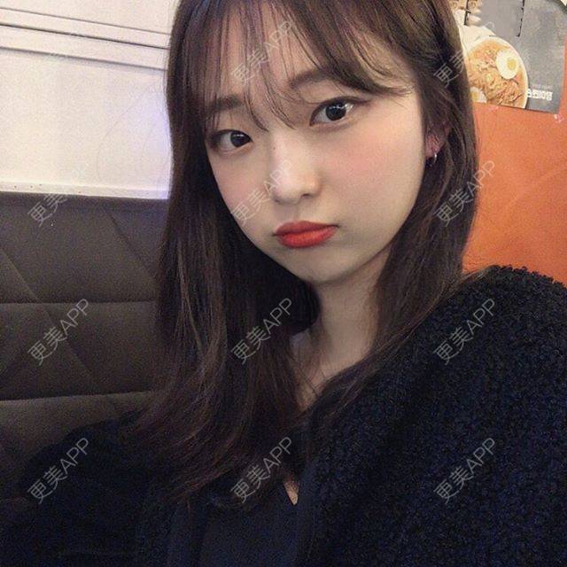 更美 - 更美用户eM50KuYcuR的鼻小柱延长经验 | 鼻小柱延长