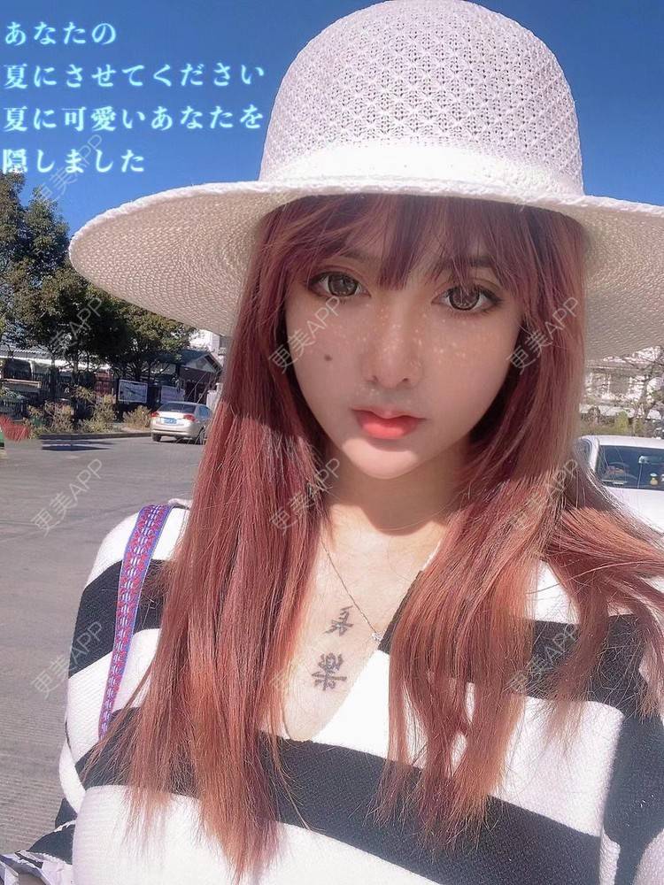 更美 - 兮兮温袅以的自体脂肪填充泪沟经验 | 自体脂肪全面部填充 | 自体脂肪丰太阳穴 | 自体脂肪丰苹果肌 | 自体脂肪丰面颊 | 自体脂肪丰额头 | 自体脂肪填充泪沟 | 自体脂肪垫下巴