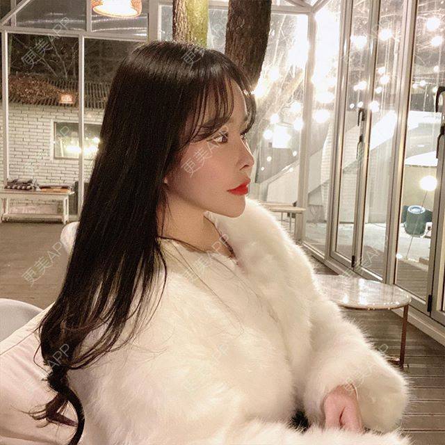 更美 - 更美用户eM50KuYcuR的眼综合修复经验 | 眼综合修复