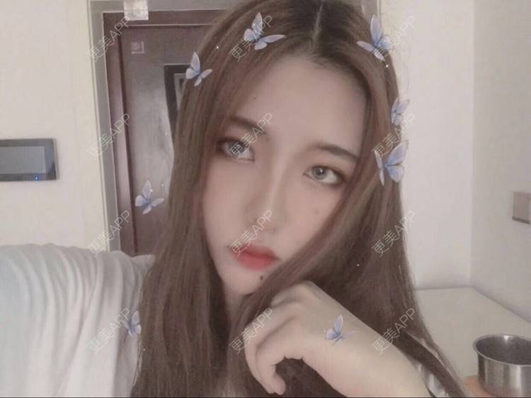 更美 - 鸿浩的腿部塑形经验 | 北京 | 视频日记 | 双下巴吸脂