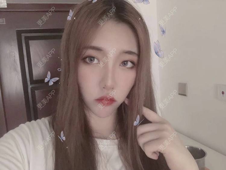 更美 - 鸿浩的腿部塑形经验 | 北京 | 视频日记 | 双下巴吸脂