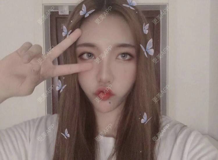 更美 - 鸿浩的腿部塑形经验 | 北京 | 视频日记 | 双下巴吸脂