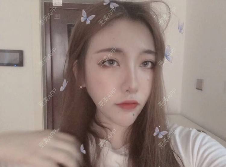 更美 - 鸿浩的腿部塑形经验 | 北京 | 视频日记 | 双下巴吸脂