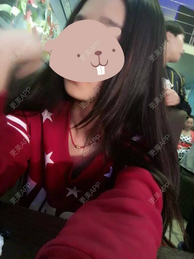 更美 - 喜新恋旧。故的阴唇整形经验 | 上海 | 阴唇整形