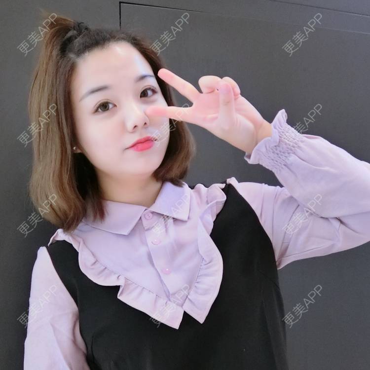 更美 - 更美用户4Z0mtKEgeK的果酸焕肤经验 | 果酸焕肤
