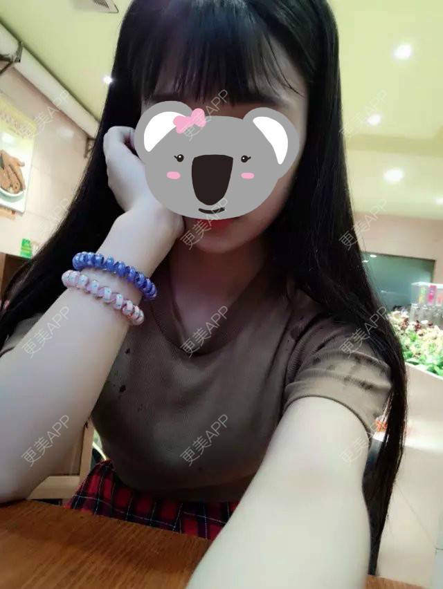 更美 - 更美用户mVbuFdvS26的阴唇整形经验 | 上海 | 阴唇整形