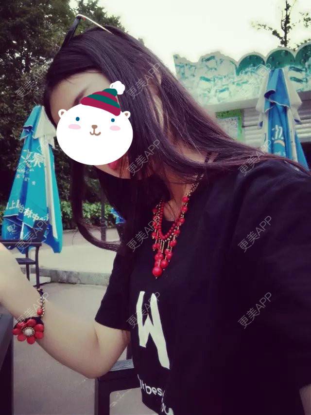 更美 - 更美用户mVbuFdvS26的阴唇整形经验 | 上海 | 阴唇整形