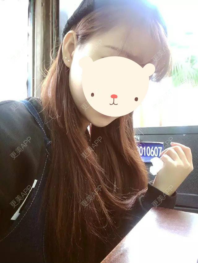 更美 - 更美用户mVbuFdvS26的阴唇整形经验 | 上海 | 阴唇整形