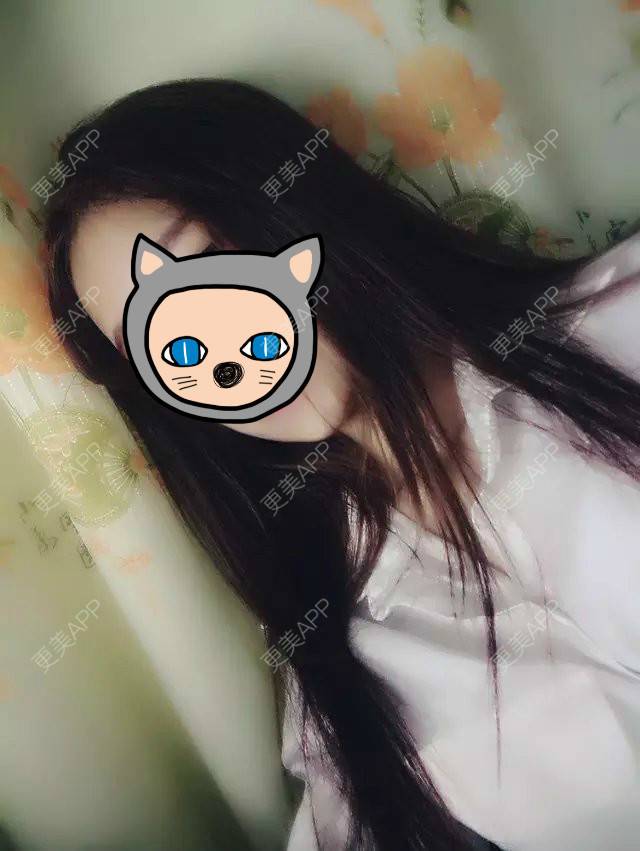 更美 - 更美用户mVbuFdvS26的阴唇整形经验 | 上海 | 阴唇整形