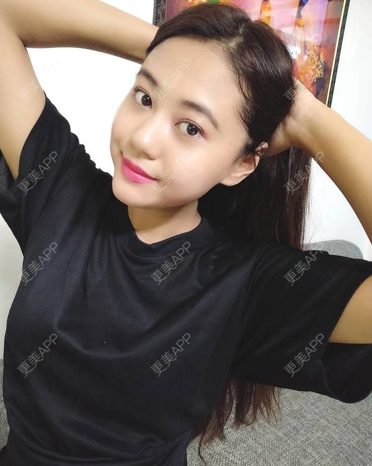 更美 - 更美用户5dDxZvihnJ的热拉提经验 | 热拉提