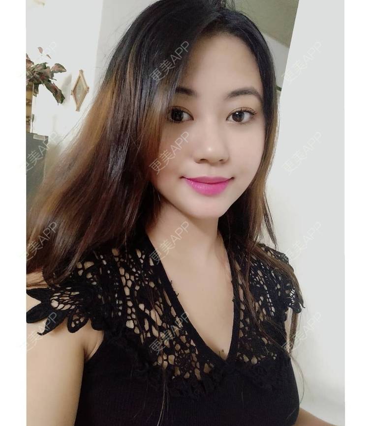 更美 - 更美用户5dDxZvihnJ的热拉提经验 | 热拉提