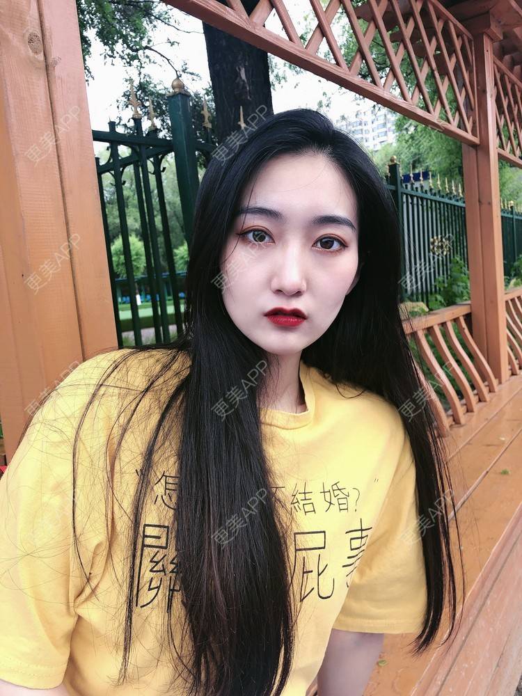 更美 - 热心市民小陈陈的轮廓修复术经验 | 轮廓修复术 | 重庆