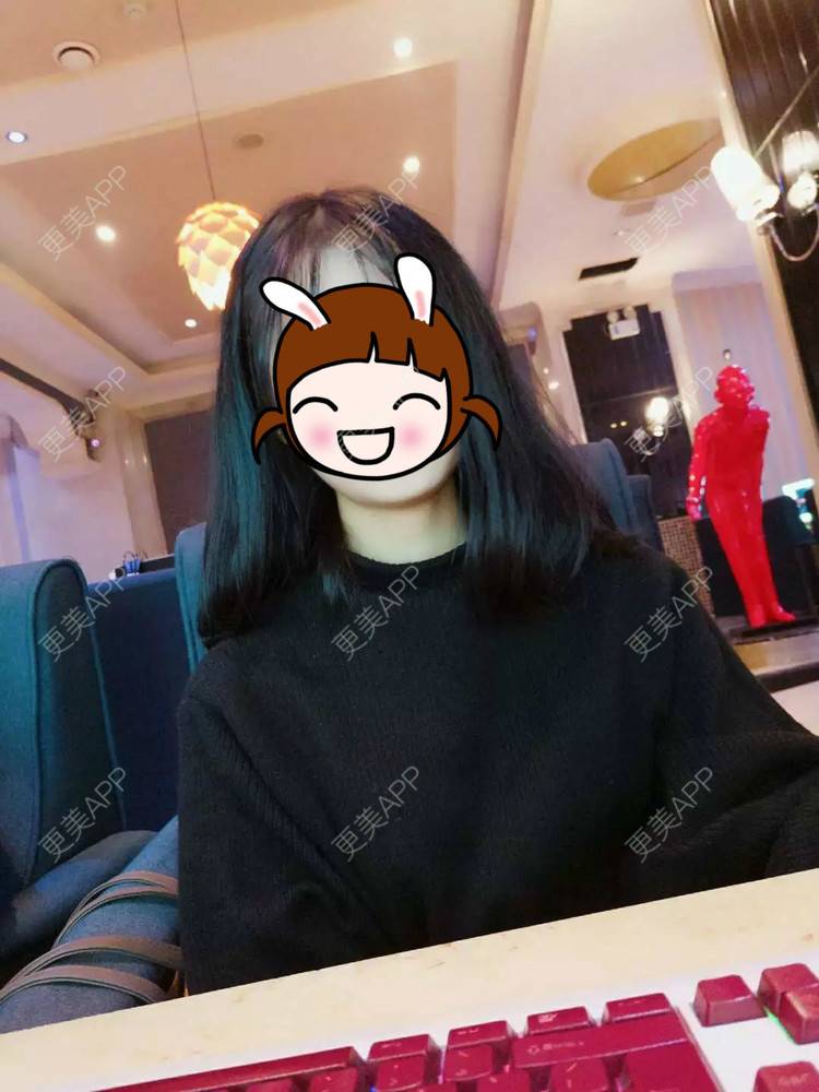 更美 - 醉了就可以表白了窖的阴唇整形经验 | 上海 | 阴唇整形