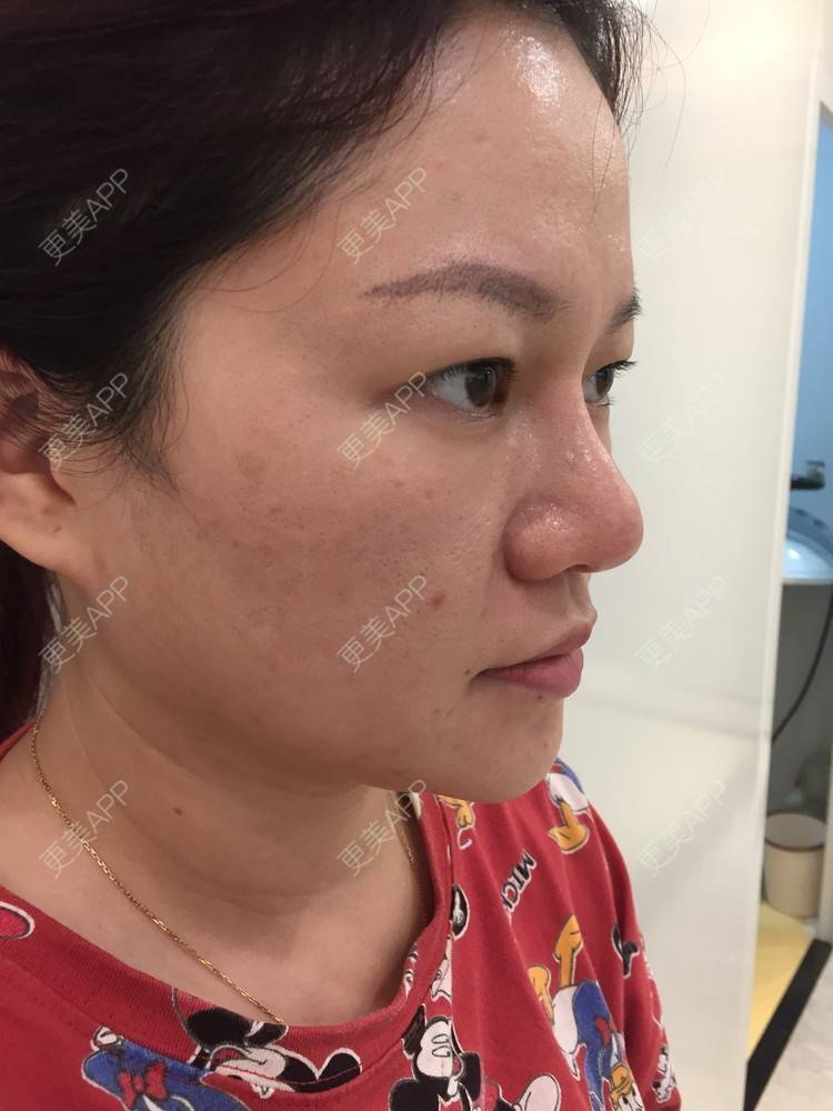 更美 - 克里克里的切眉经验 | 切眉 | 深圳