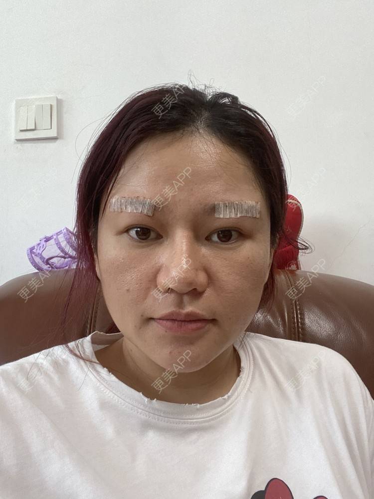 更美 - 克里克里的切眉经验 | 切眉 | 深圳