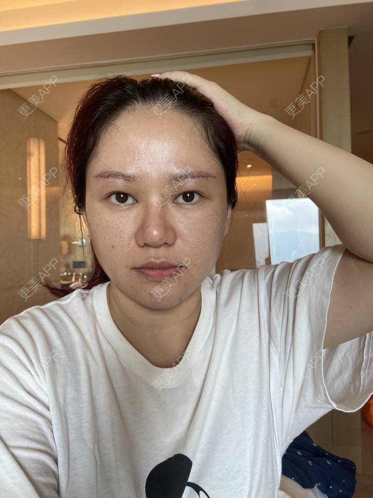 更美 - 克里克里的切眉经验 | 切眉 | 深圳