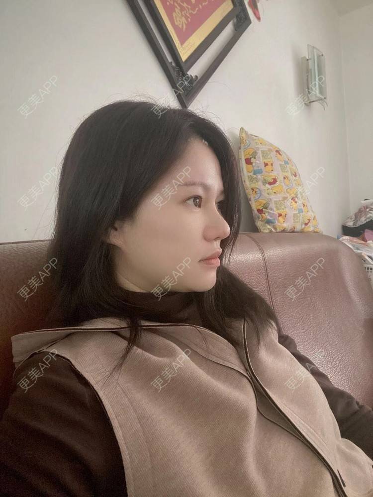 更美 - 克里克里的切眉经验 | 切眉 | 深圳