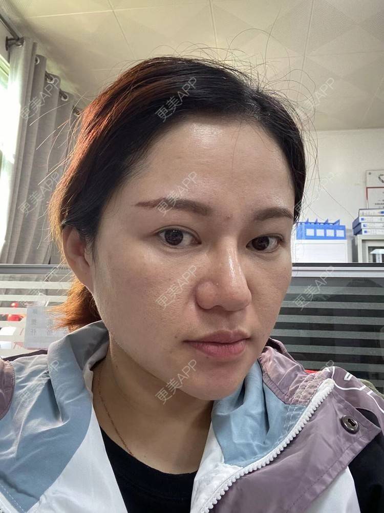 更美 - 克里克里的切眉经验 | 切眉 | 深圳