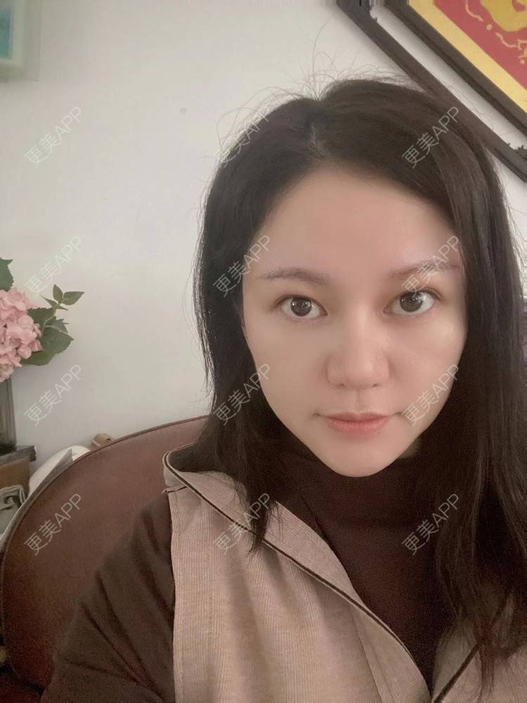 更美 - 克里克里的切眉经验 | 切眉 | 深圳