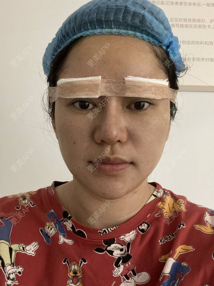 更美 - 克里克里的切眉经验 | 切眉 | 深圳
