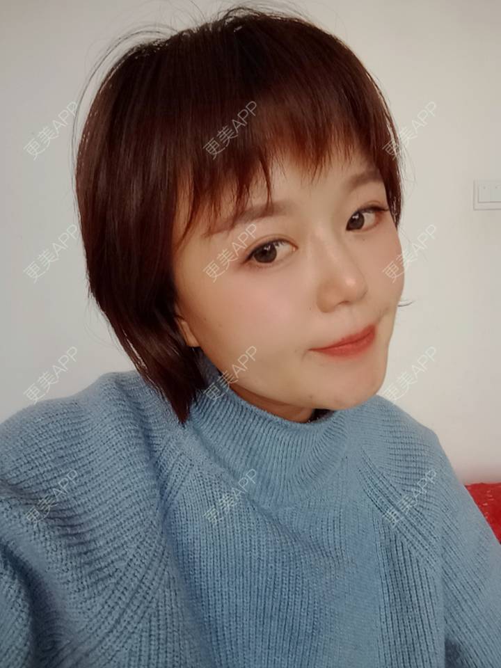 更美 - 乘风破浪小美眉的开外眼角经验 | 开外眼角 | 重庆 | 提眉修复