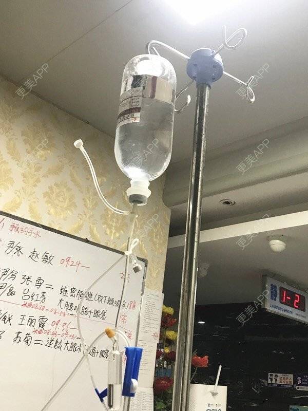 更美 - 更美用户8ZtJfJloBn的双下巴吸脂经验 | 双下巴吸脂 | 昆明