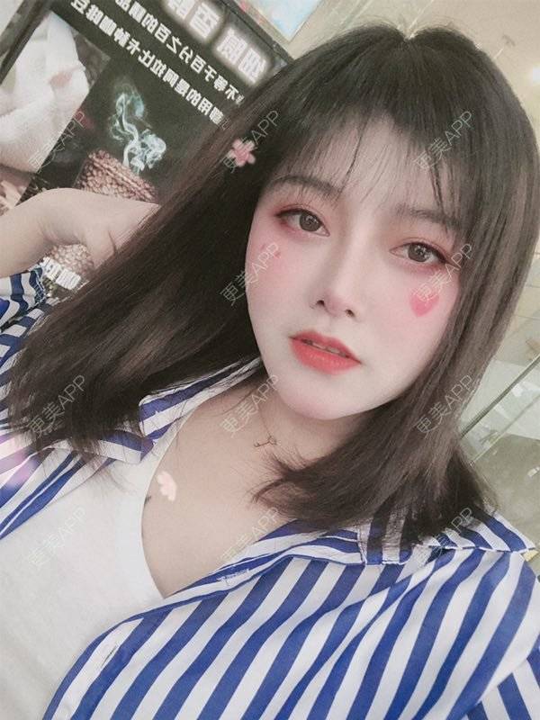 更美 - 小泥泥的吸脂瘦脸经验 | 吸脂瘦脸 | 双下巴吸脂 | 深圳