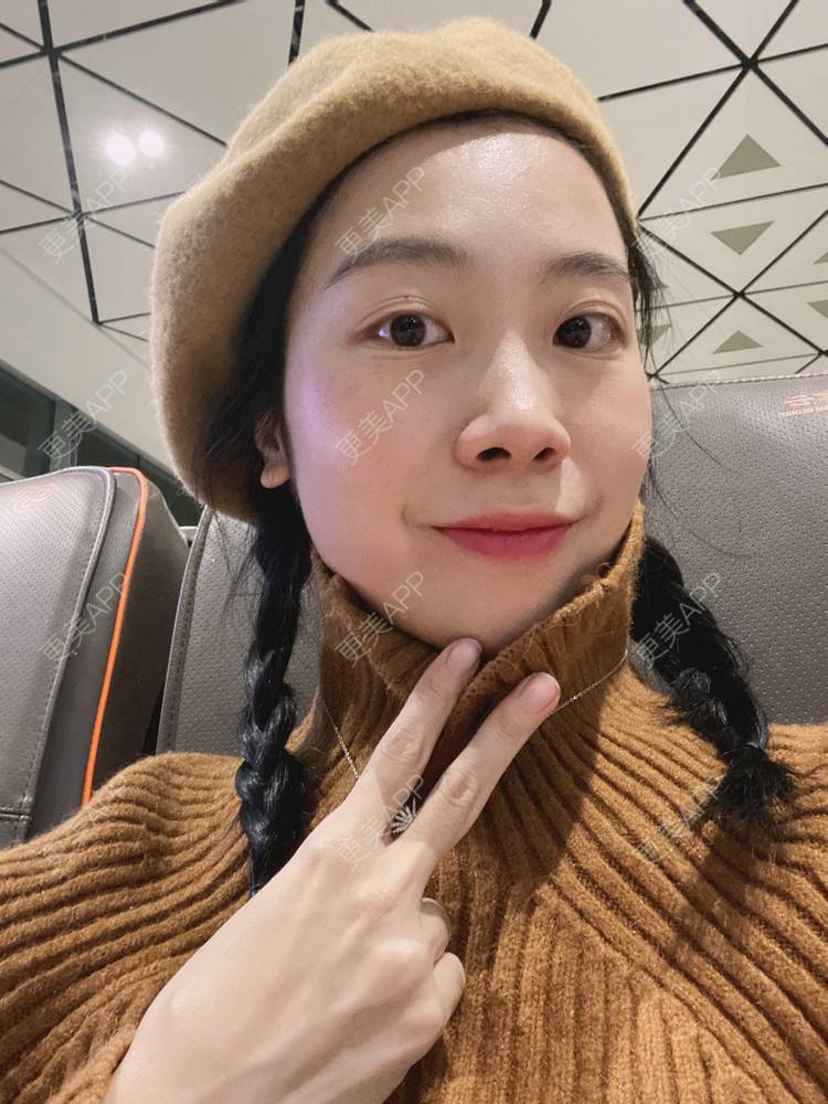 更美 - 更美用户IwEnKzK4nU的黄金微针经验 | 黄金微针 | 广州