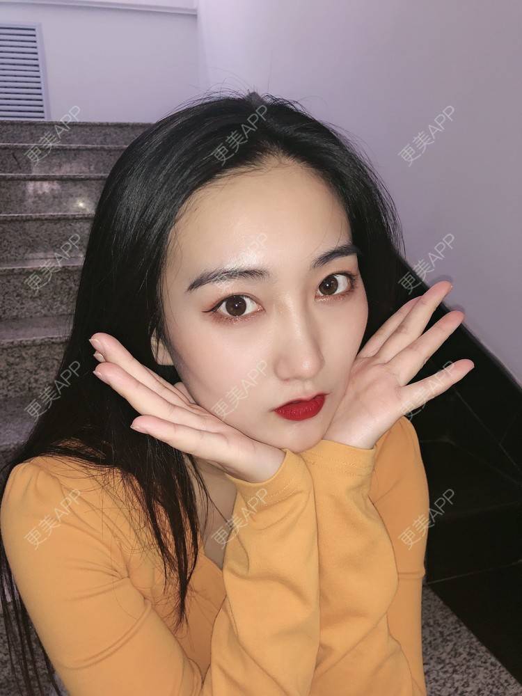 更美 - 热心市民小陈陈的轮廓修复术经验 | 轮廓修复术 | 重庆
