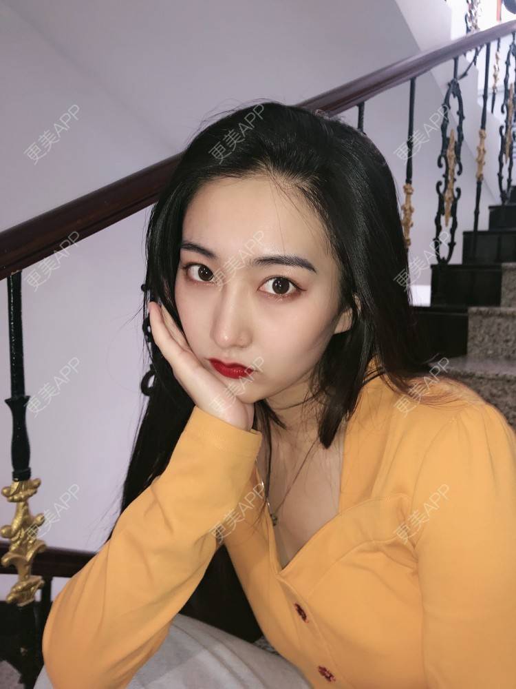 更美 - 热心市民小陈陈的轮廓修复术经验 | 轮廓修复术 | 重庆