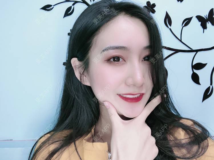 更美 - 热心市民小陈陈的轮廓修复术经验 | 轮廓修复术 | 重庆