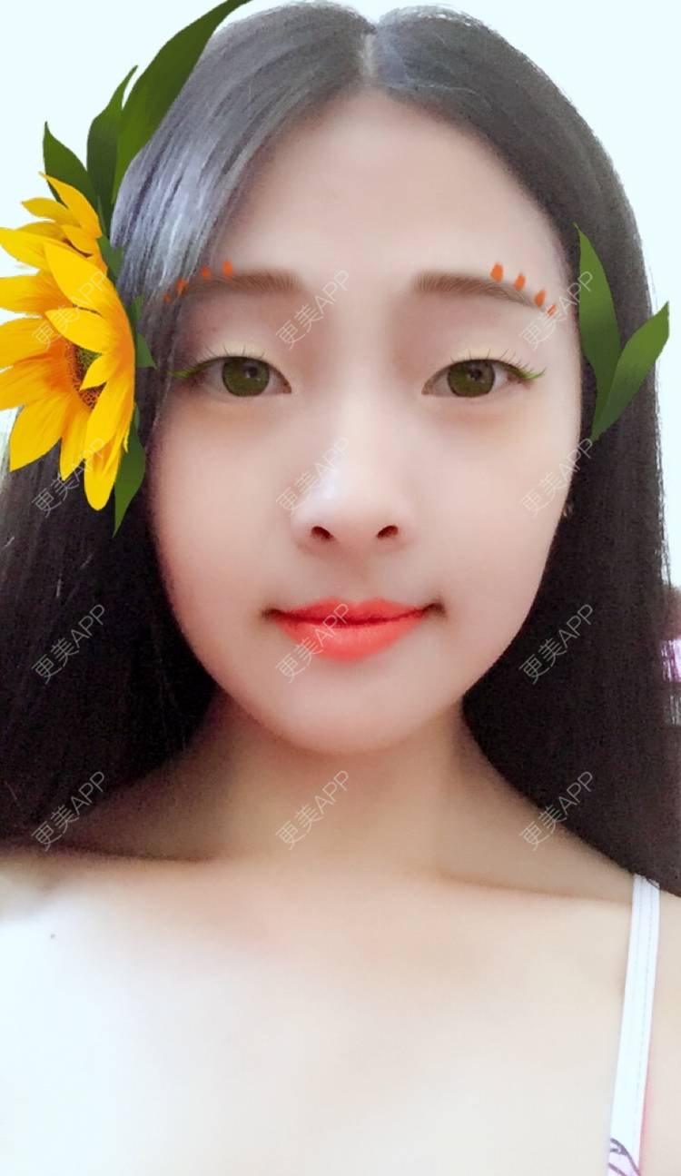 更美 - 更美用户DVJNfKigag的光子嫩肤经验 | 光子嫩肤