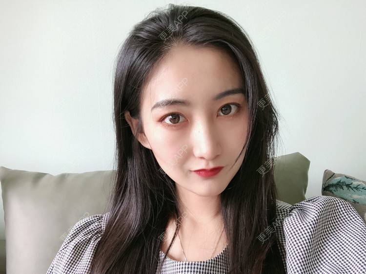 更美 - 热心市民小陈陈的轮廓修复术经验 | 轮廓修复术 | 重庆