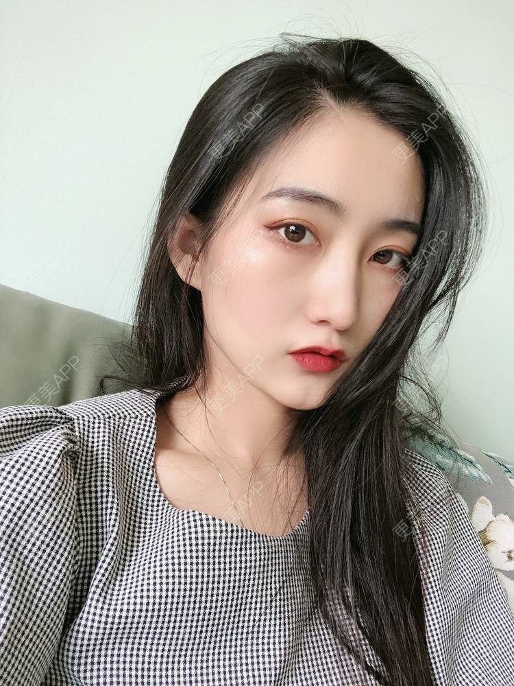 更美 - 热心市民小陈陈的轮廓修复术经验 | 轮廓修复术 | 重庆