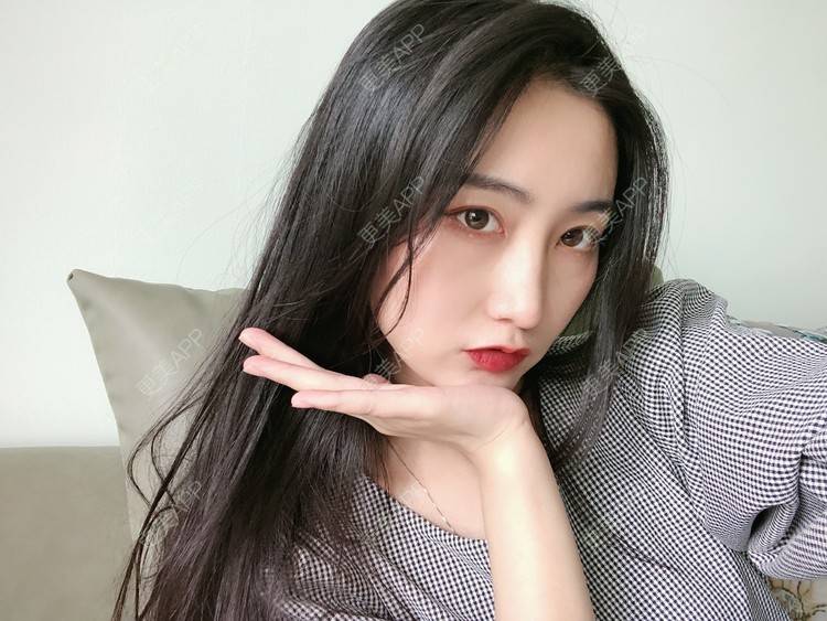 更美 - 热心市民小陈陈的轮廓修复术经验 | 轮廓修复术 | 重庆