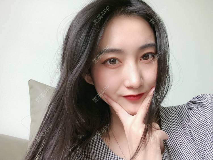 更美 - 热心市民小陈陈的轮廓修复术经验 | 轮廓修复术 | 重庆