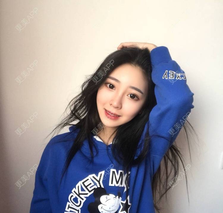 更美 - 迷乱花海拐的微针水光经验 | 德州 | 微针水光