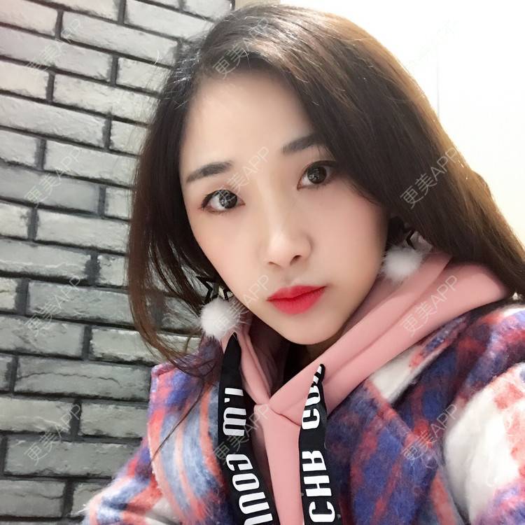 更美 - honey堤的光子嫩肤经验 | 北京 | 光子嫩肤