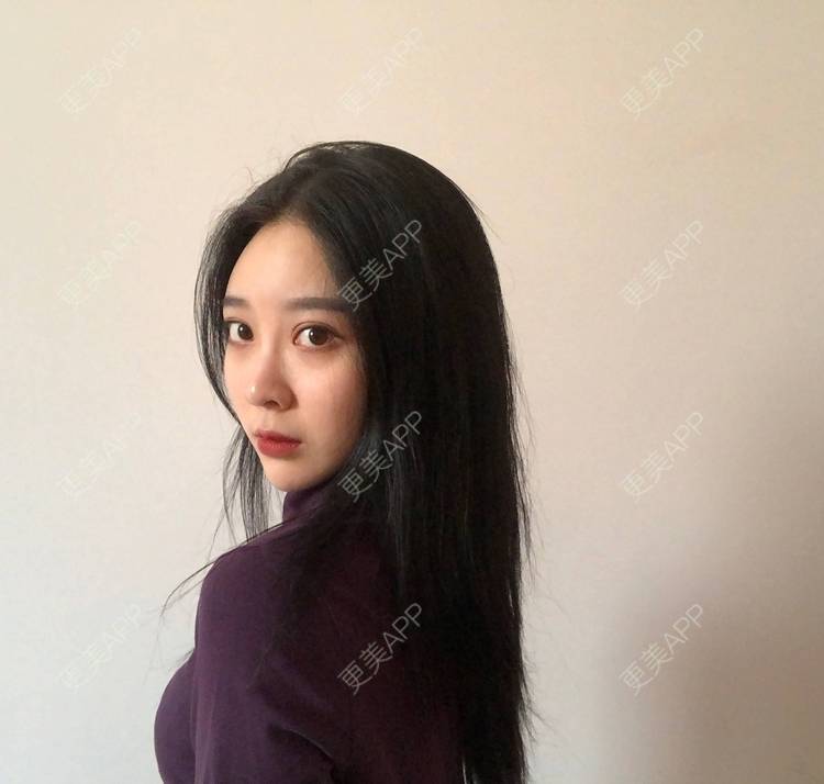 更美 - 迷乱花海拐的微针水光经验 | 德州 | 微针水光