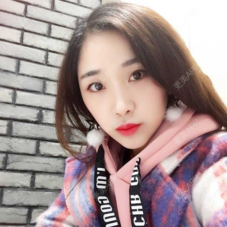 更美 - honey堤的光子嫩肤经验 | 北京 | 光子嫩肤